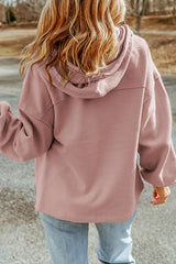 Casual Solid Zipper Hooded Collar Outerwear(5 Colors)